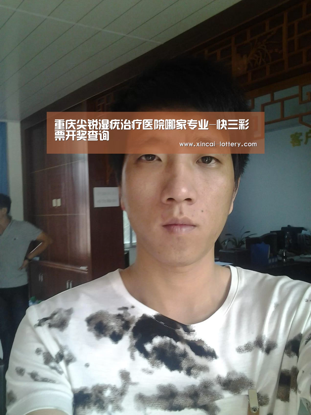 重庆尖锐湿疣治疗医院哪家专业-快三彩票开奖查询(图3) 快三彩票走势分析