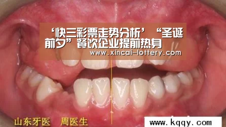 快三彩票走势分析